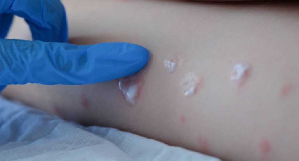 N5R7KWATIVARLOB4E3A5IOGIRQ